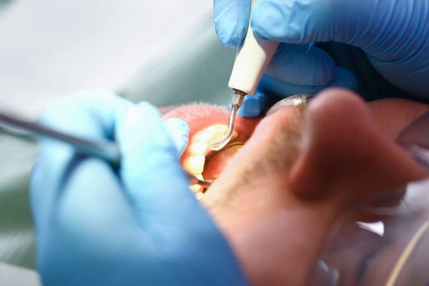 Best Weekend Emergency Dentist in Jonesboro, IN